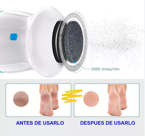Removedor de callos: Aprovecha 50% de descuento!!